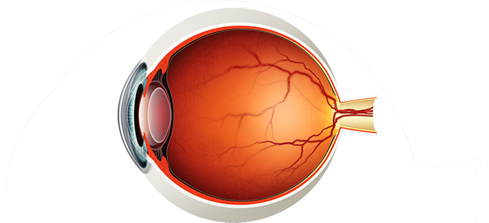 Medical Retina Treatment for Diabetic Retinopathy in Hyderabad